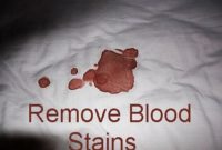 remove blood